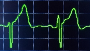 Read more about the article Selbstdiagnose mit Buoy Health